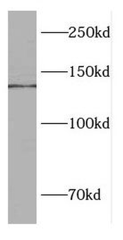 LIG1 Rabbit Polyclonal Antibody