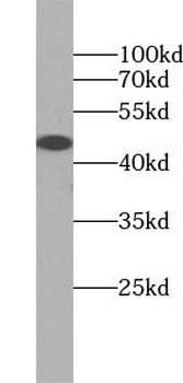 DNAJA1 Rabbit Polyclonal Antibody