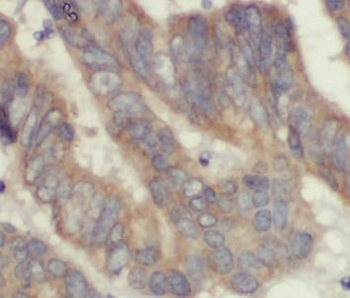 DNAJA1 Rabbit Polyclonal Antibody