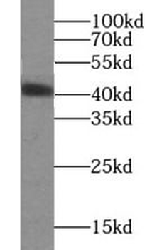 DNAJB1 Rabbit Polyclonal Antibody