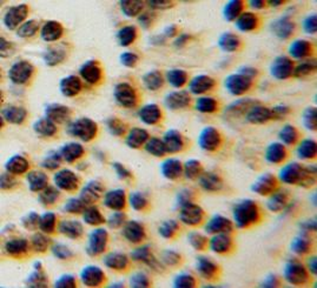DNAJB1 Rabbit Polyclonal Antibody