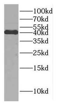 DNAJB11 Rabbit Polyclonal Antibody