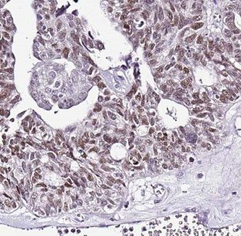 DNAJB11 Rabbit Polyclonal Antibody