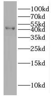DNAJB12 Rabbit Polyclonal Antibody