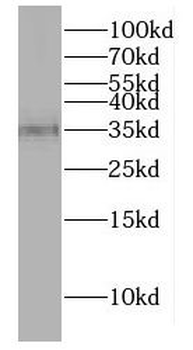 DNAJB13 Rabbit Polyclonal Antibody