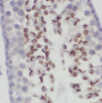 DNAJB13 Rabbit Polyclonal Antibody