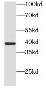 DNAJB5 Rabbit Polyclonal Antibody
