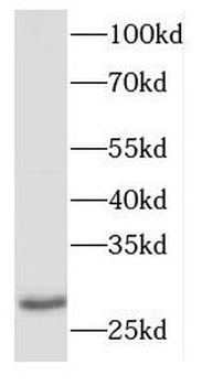 DNAJB9 Rabbit Polyclonal Antibody