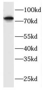 DNAJC10 Rabbit Polyclonal Antibody