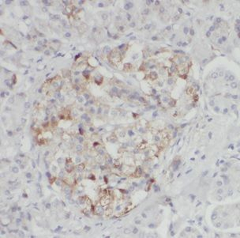 DNAJC10 Rabbit Polyclonal Antibody