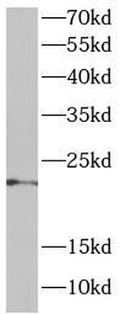 DNAJC12 Rabbit Polyclonal Antibody