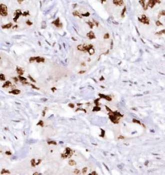 DNAJC12 Rabbit Polyclonal Antibody