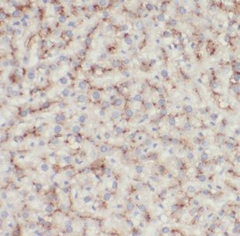 DNAJC15 Rabbit Polyclonal Antibody