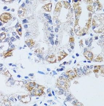 DNAJC19 Rabbit Polyclonal Antibody