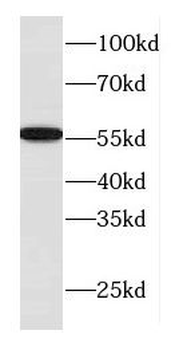 DNAJC7 Rabbit Polyclonal Antibody