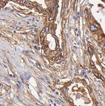 DNAJC7 Rabbit Polyclonal Antibody