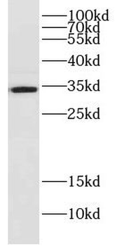 DNAJC9 Rabbit Polyclonal Antibody