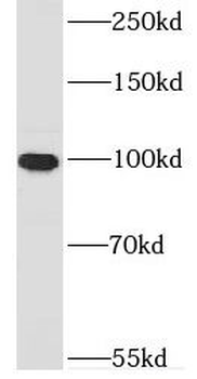DNM3 Rabbit Polyclonal Antibody