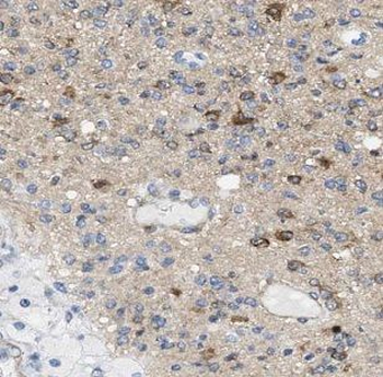 DNM3 Rabbit Polyclonal Antibody
