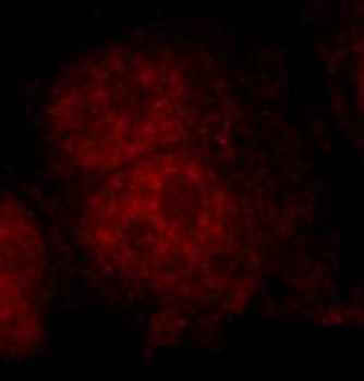 DNMT1 Rabbit Polyclonal Antibody
