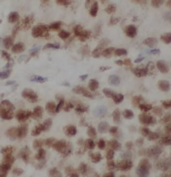 DNMT1 Rabbit Polyclonal Antibody