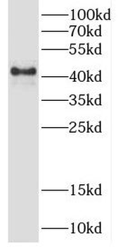 TRDMT1 Rabbit Polyclonal Antibody