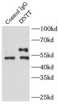 DNTT Rabbit Polyclonal Antibody