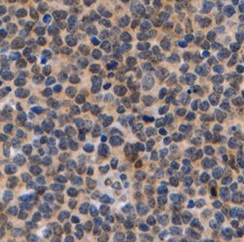 DNTT Rabbit Polyclonal Antibody