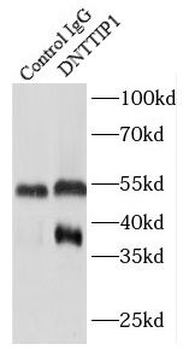 DNTTIP1 Rabbit Polyclonal Antibody
