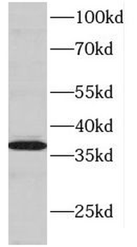 DNTTIP1 Rabbit Polyclonal Antibody