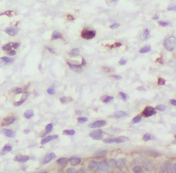 DXO Rabbit Polyclonal Antibody