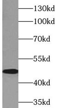DPEP1 Rabbit Polyclonal Antibody