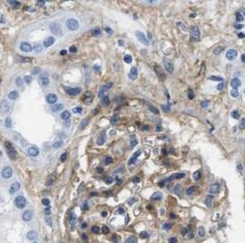 DPEP1 Rabbit Polyclonal Antibody