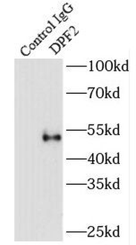 DPF2 Rabbit Polyclonal Antibody