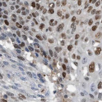 DPF2 Rabbit Polyclonal Antibody