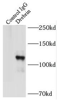 DBN1 Rabbit Polyclonal Antibody