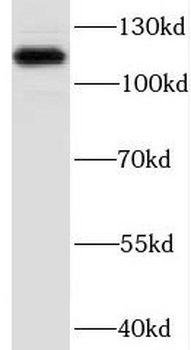 DBN1 Rabbit Polyclonal Antibody