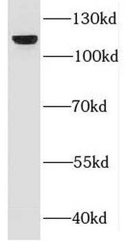 DBN1 Rabbit Polyclonal Antibody