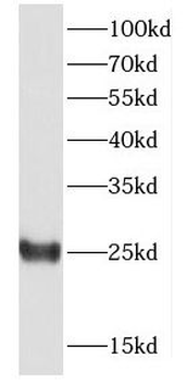 DTD1 Rabbit Polyclonal Antibody