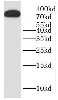 DTX3L Rabbit Polyclonal Antibody