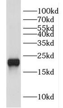 DUSP22 Rabbit Polyclonal Antibody
