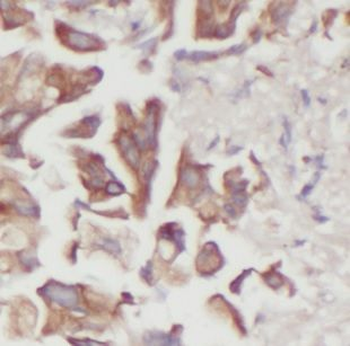 DUSP22 Rabbit Polyclonal Antibody