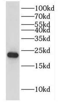 DUSP22 Rabbit Polyclonal Antibody