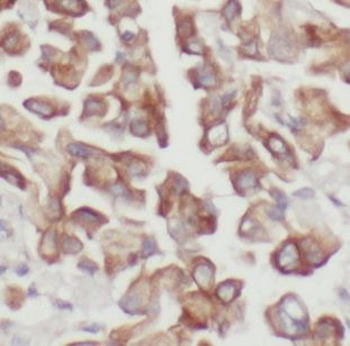 DUSP22 Rabbit Polyclonal Antibody