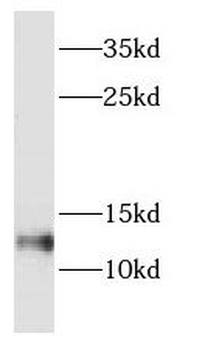 DYNLT1 Rabbit Polyclonal Antibody