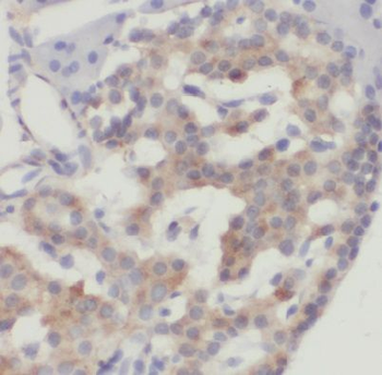 DYNLT1 Rabbit Polyclonal Antibody