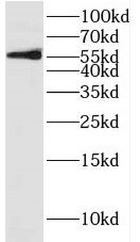 DYRK1B Rabbit Polyclonal Antibody