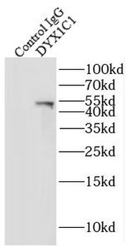 DNAAF4 Rabbit Polyclonal Antibody