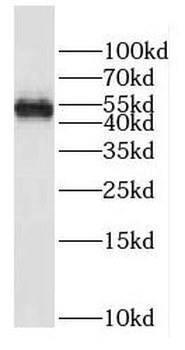 DNAAF4 Rabbit Polyclonal Antibody