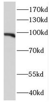 E2F7 Rabbit Polyclonal Antibody